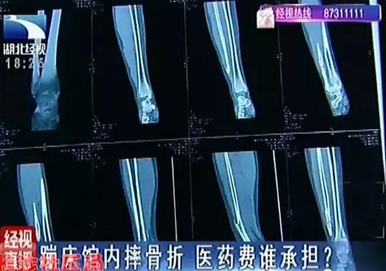 儿童充气蹦蹦床厂家_福建泉州女童蹦床事故 医生提醒 幼童 不宜玩 蹦床 高位截瘫_8岁女童玩蹦床坠落 昏迷 重症病房 呼吸机 维持生命体征