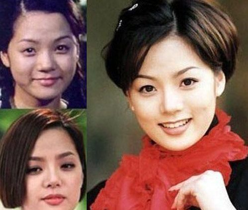 蔡琳离婚后嫁给高梓淇 坦言当中国媳妇轻松 整形后好别扭 蔡琳离婚后嫁给高梓淇 坦言当中国媳妇轻松 整形后好别扭